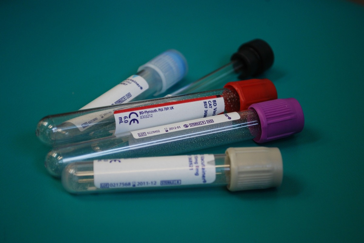 Laos mueble Profesión Orden de llenado de tubos de muestras sanguíneas: ¿Cuál es el correcto? 1ª  parte. – UN ENFERMERO CURIOSO